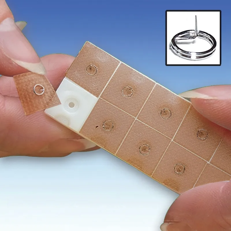 Ohr-Dauernadeln ratiomed, 0,20 x 1,3 (10 x 10 Stck.)