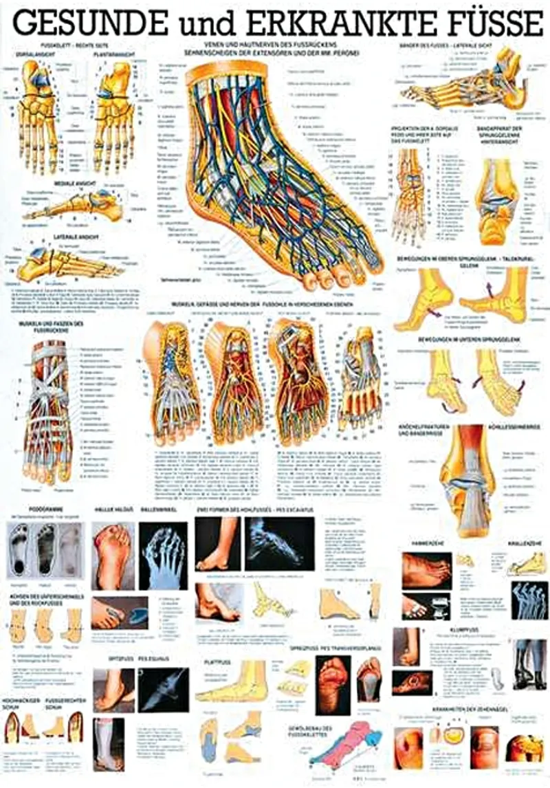 Anat. Lehrtafel: Gesunde und erkrankte, Füße 70 x 100 cm, laminiert