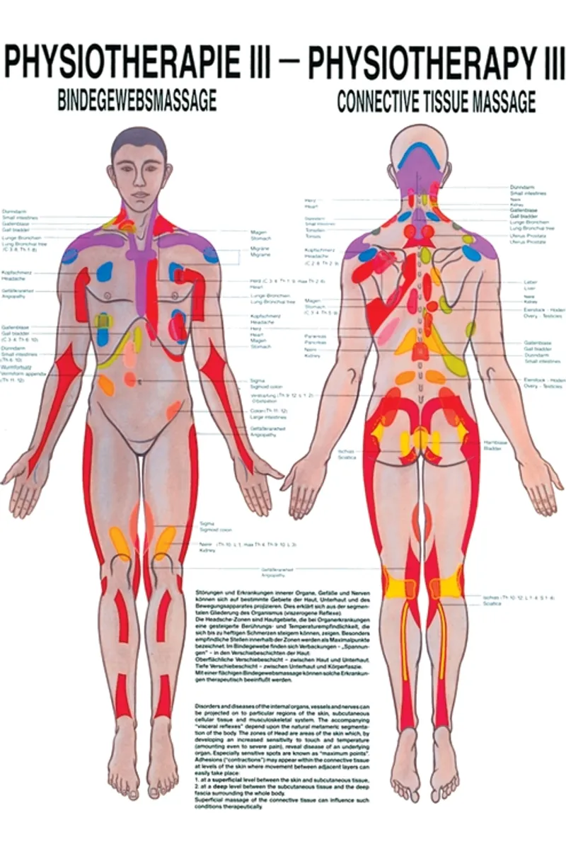 Anat. Poster: Physiotherapie, Bindegewebsmassage, 50 x 70 cm, Papier