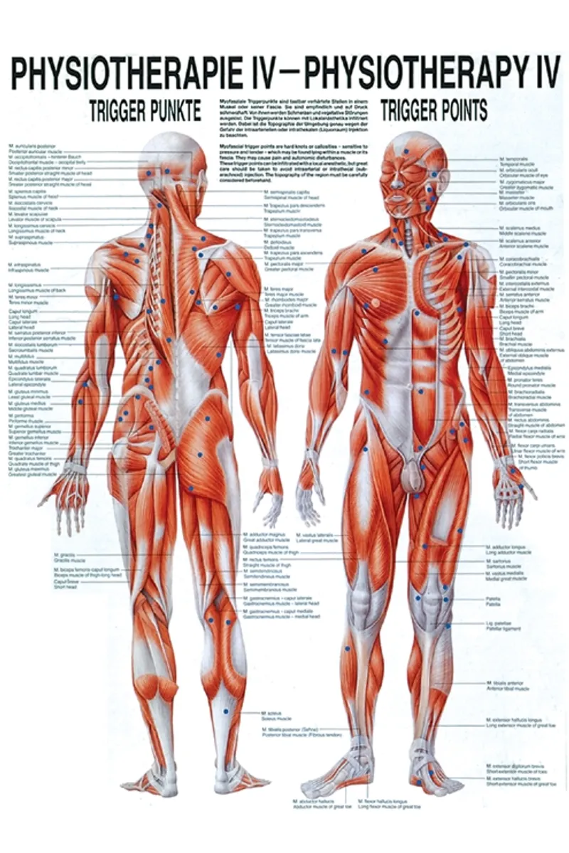 Anat. Poster: Physiotherapie, Triggerpunkte, 50 x 70 cm, Papier